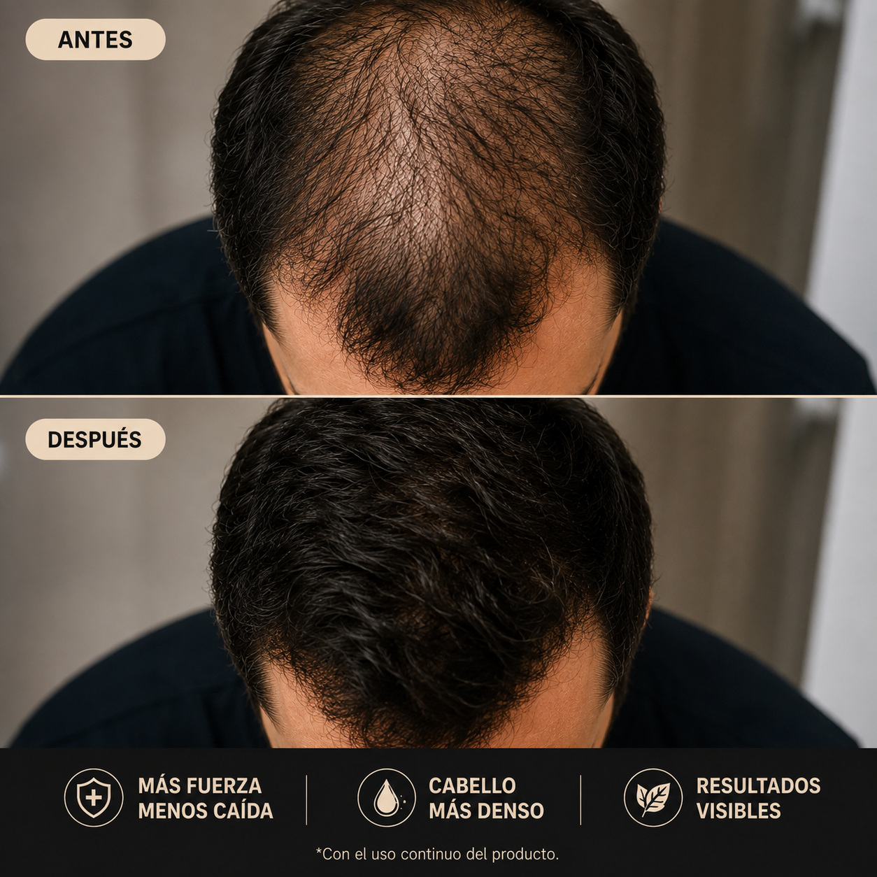 Promocion SHAMPOO EXCALVO 2x1 Recupera tu cabello o te devolvemos tu dinero